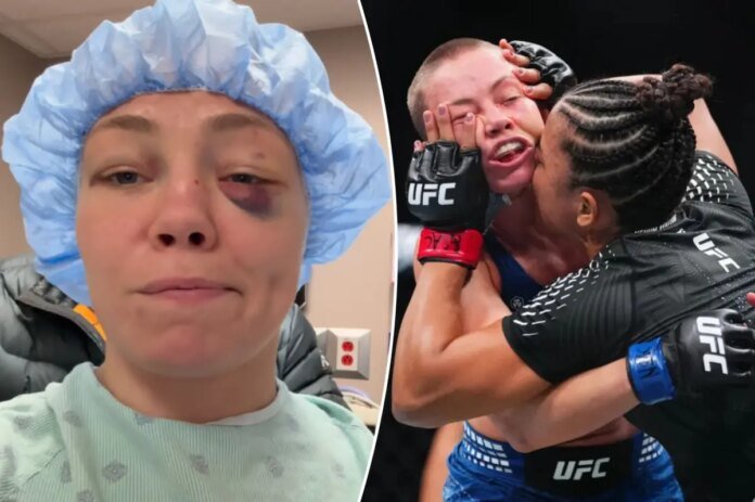 UFCs-Rose-Namajunas-wont-be-able-to-blow-nose-sneeze.jpg