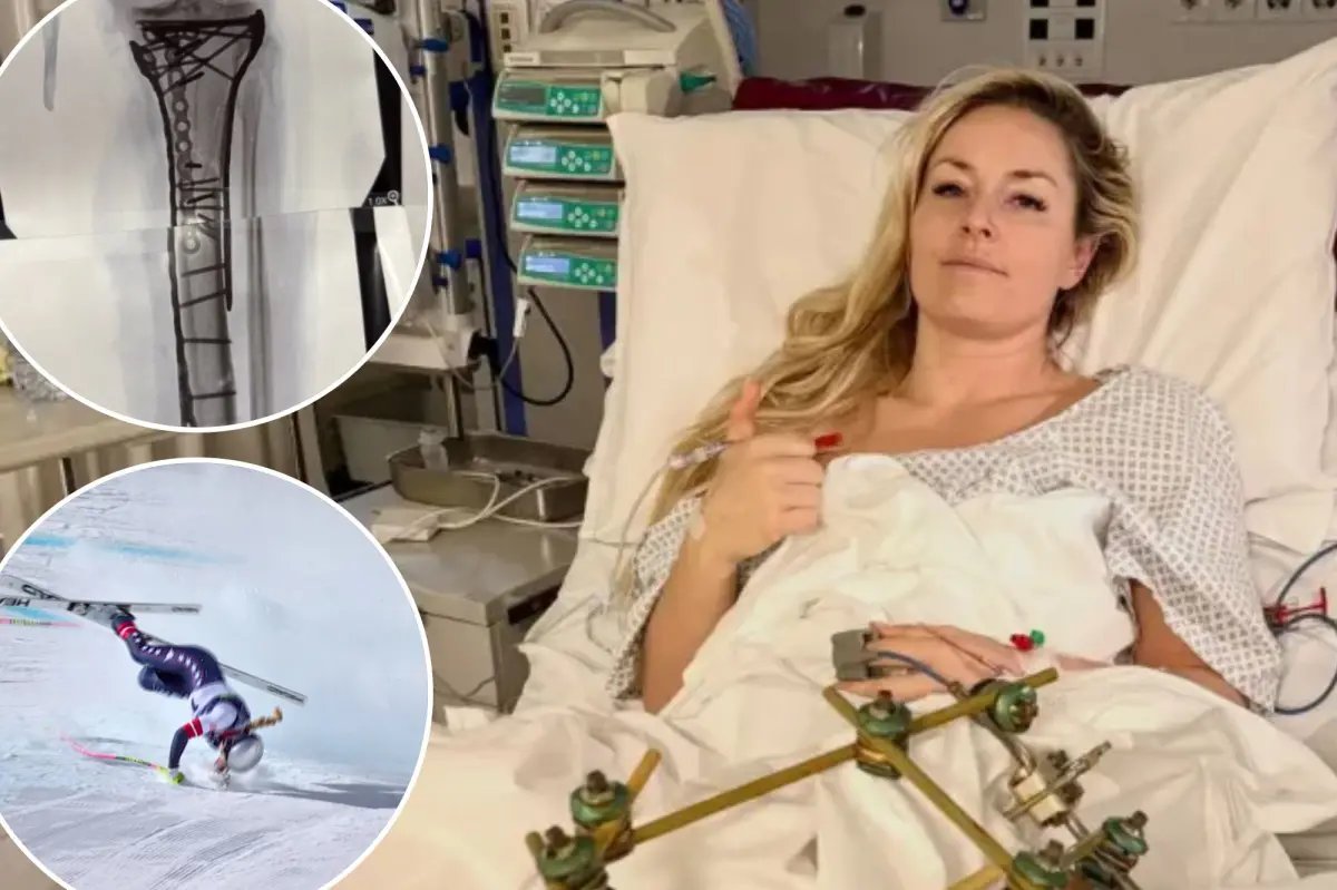 Lindsey Vonn offers gruesome update after Olympic crash: ‘Bionic for real now’