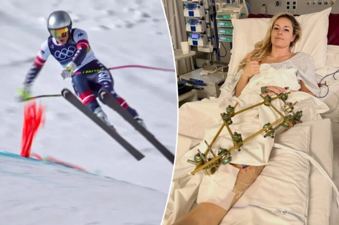 Lindsey-Vonn-returning-to-US-after-revealing-fourth-surgery-went.jpg