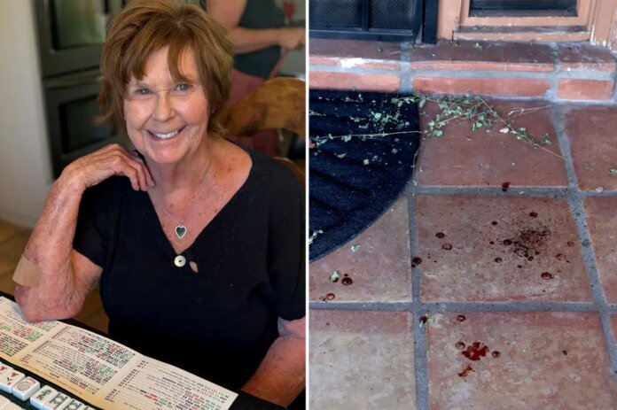 Nancy-Guthrie-DNA-splatter-shows-she-was-bleeding-from-‘either.jpg