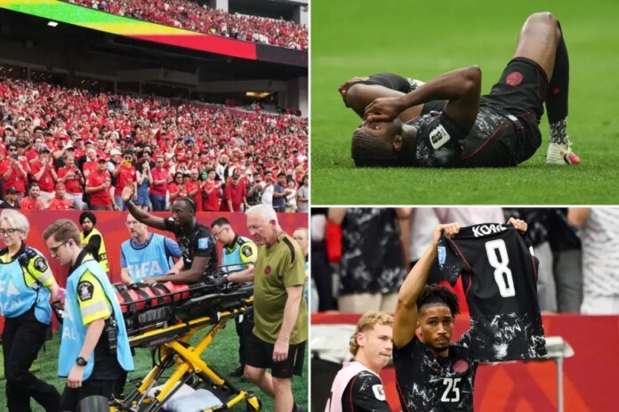 Ismael-Kone-leaves-World-Cup-game-early-with-serious-leg.jpg